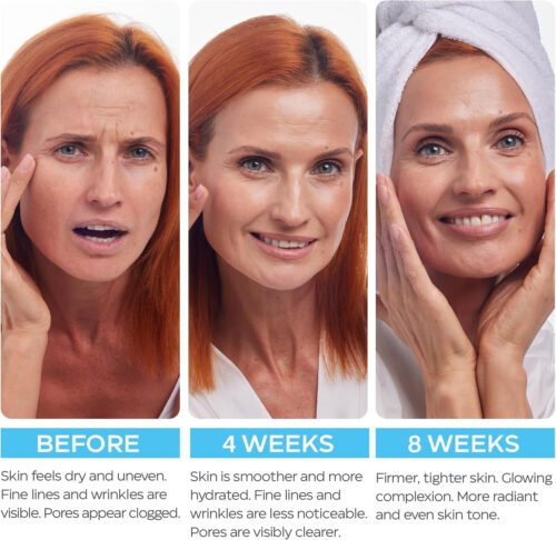 Retinol Cream for Face with Hyaluronic Acid, Collagen Day & Night Moisturizer for Women and Men, Age Solution Cream, 1.85 Oz - Image 7